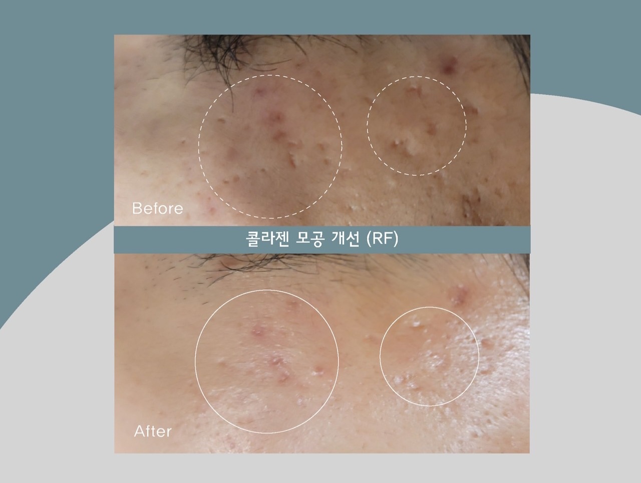 더어려지다에스테틱