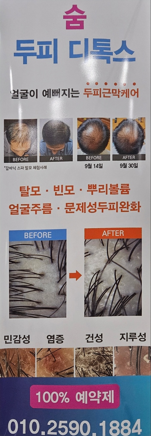 숨두피 대표 이미지