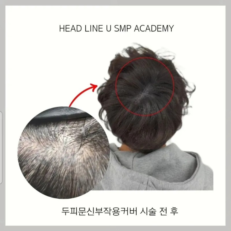 헤드라인유 대표 이미지