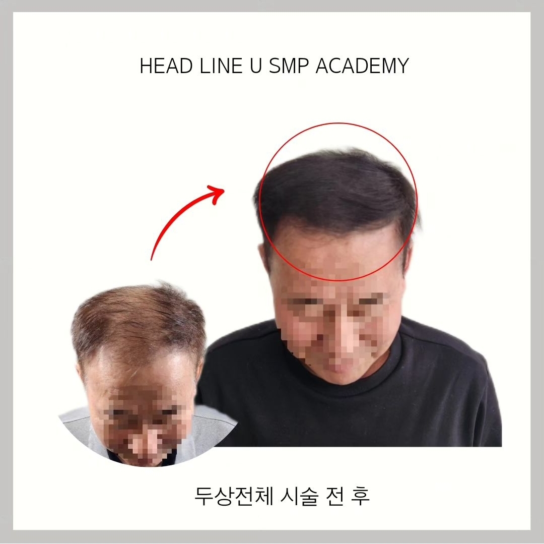 헤드라인유 대표 이미지