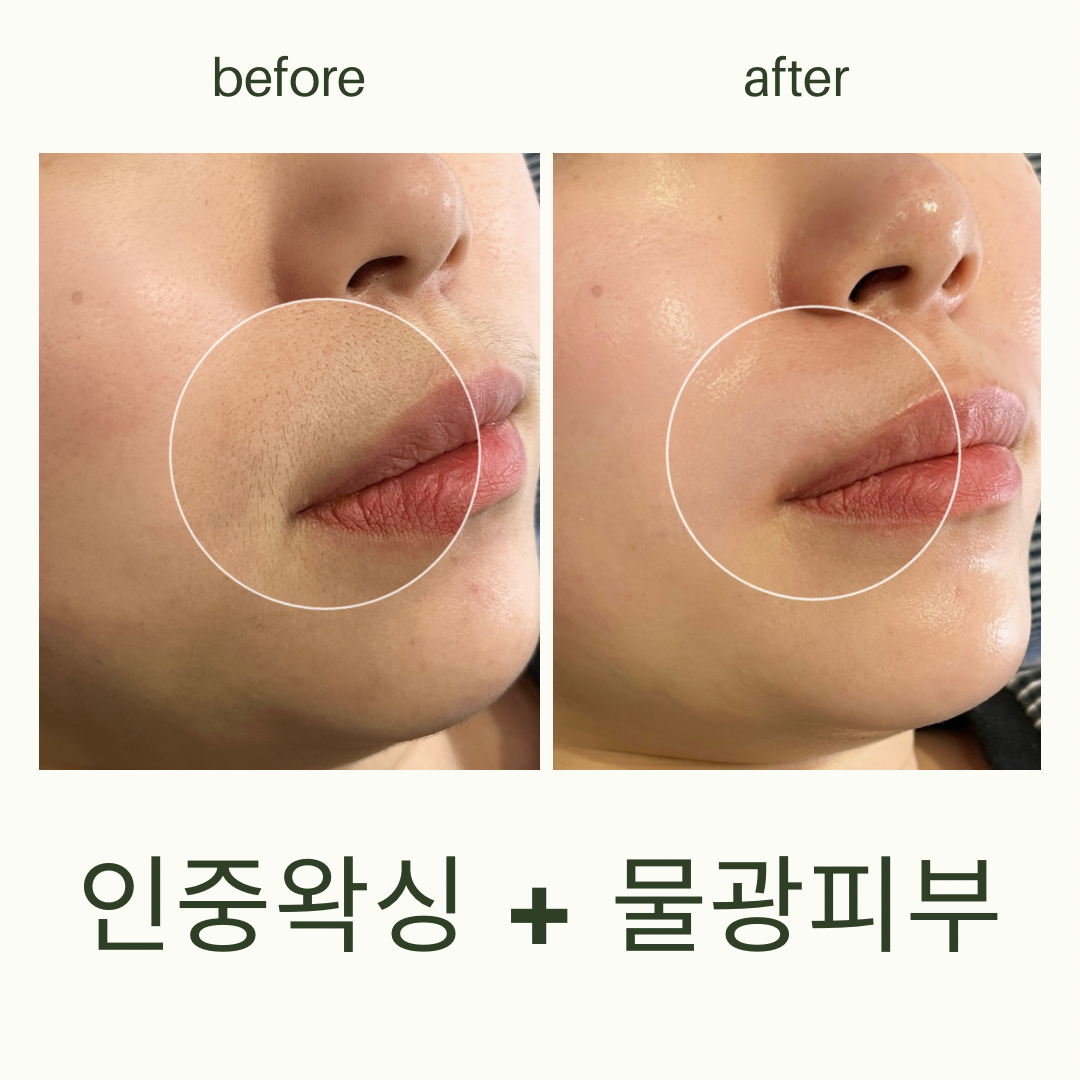 삼월뷰티 왁싱 서면전포점