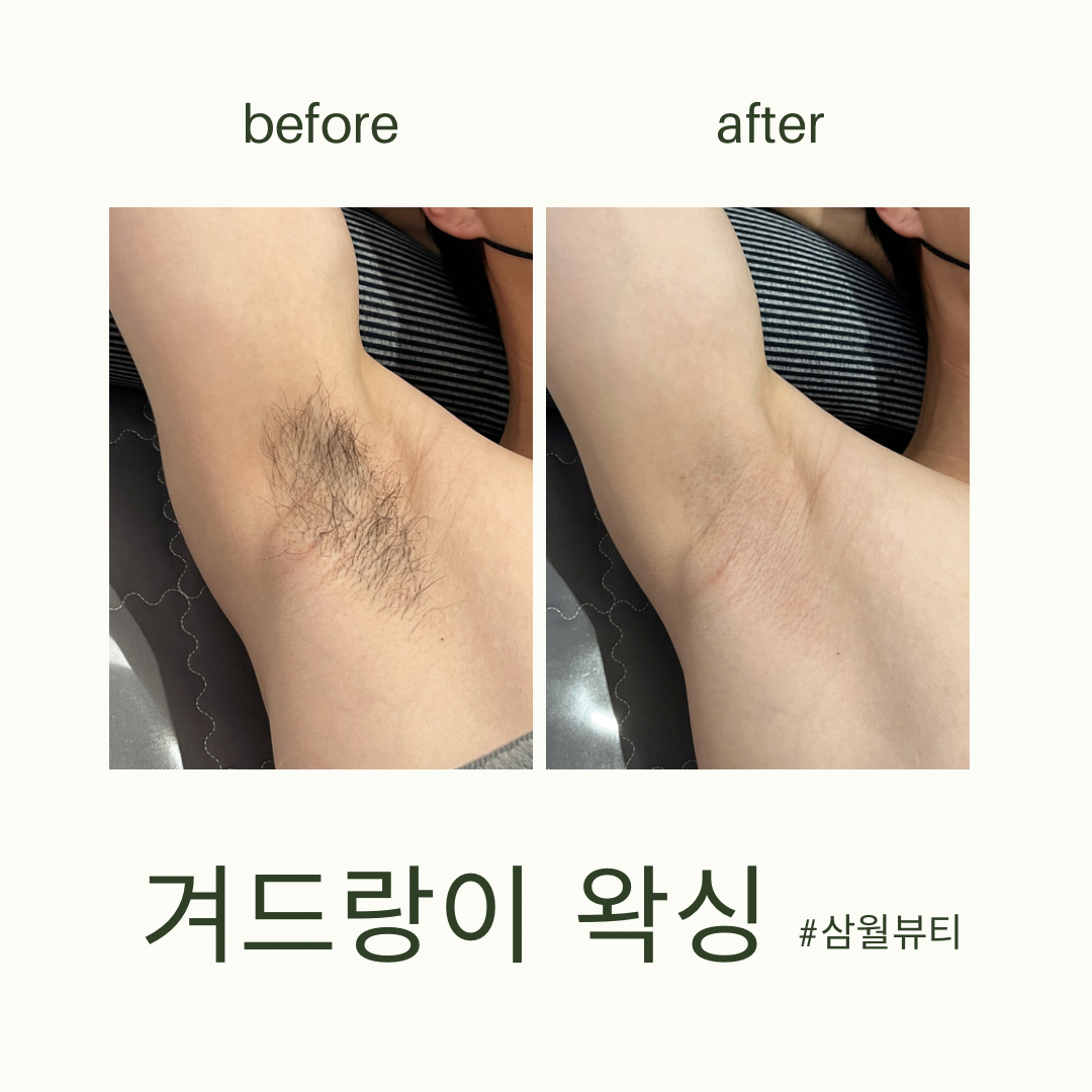 삼월뷰티 왁싱 서면전포점