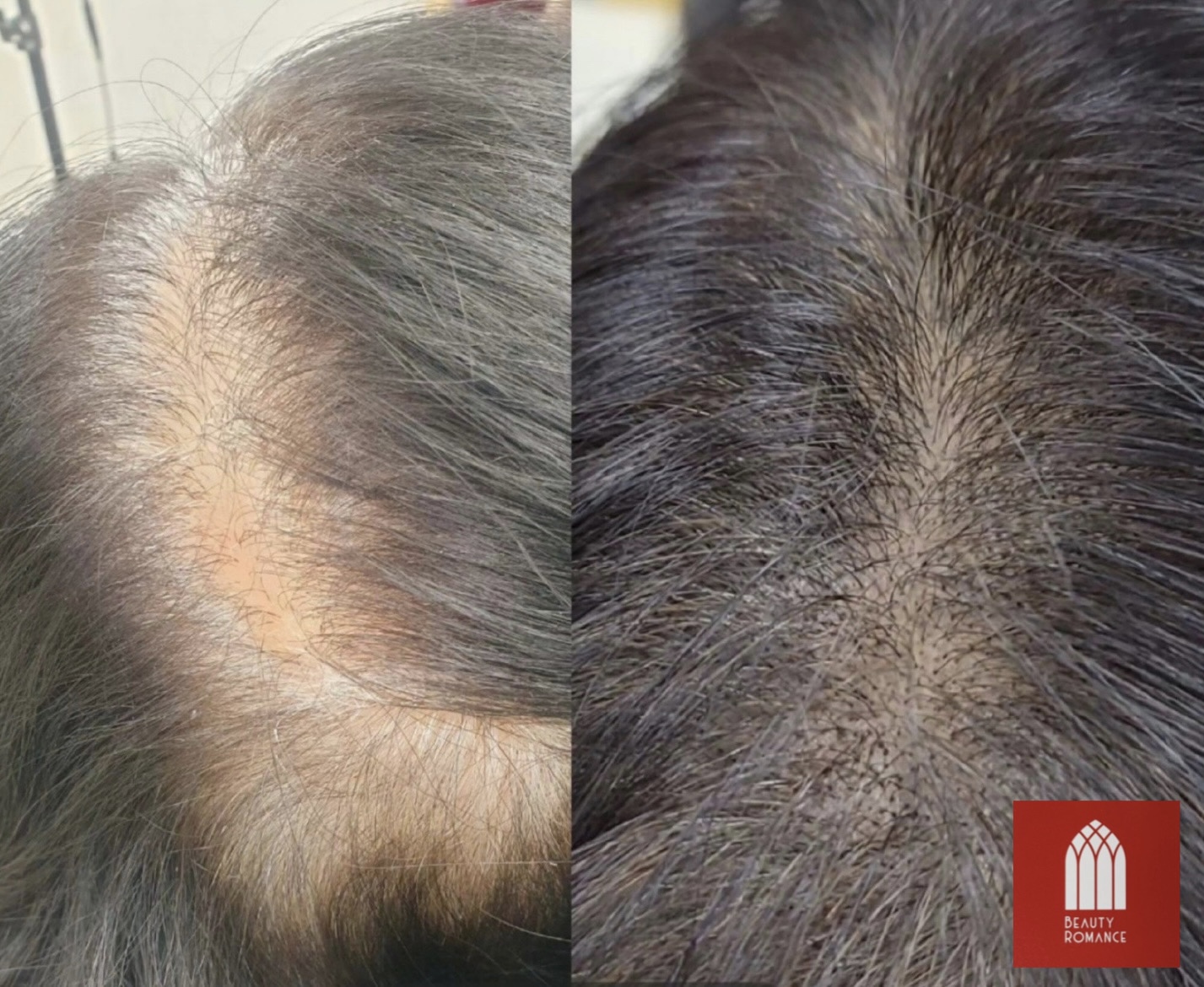 뷰티로망스 대표 이미지