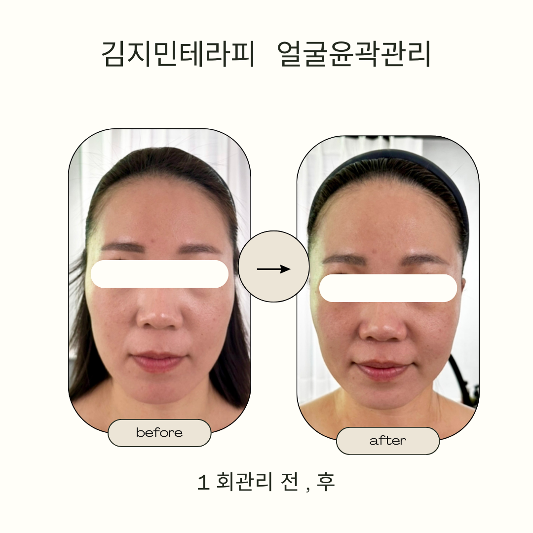 김지민약손테라피