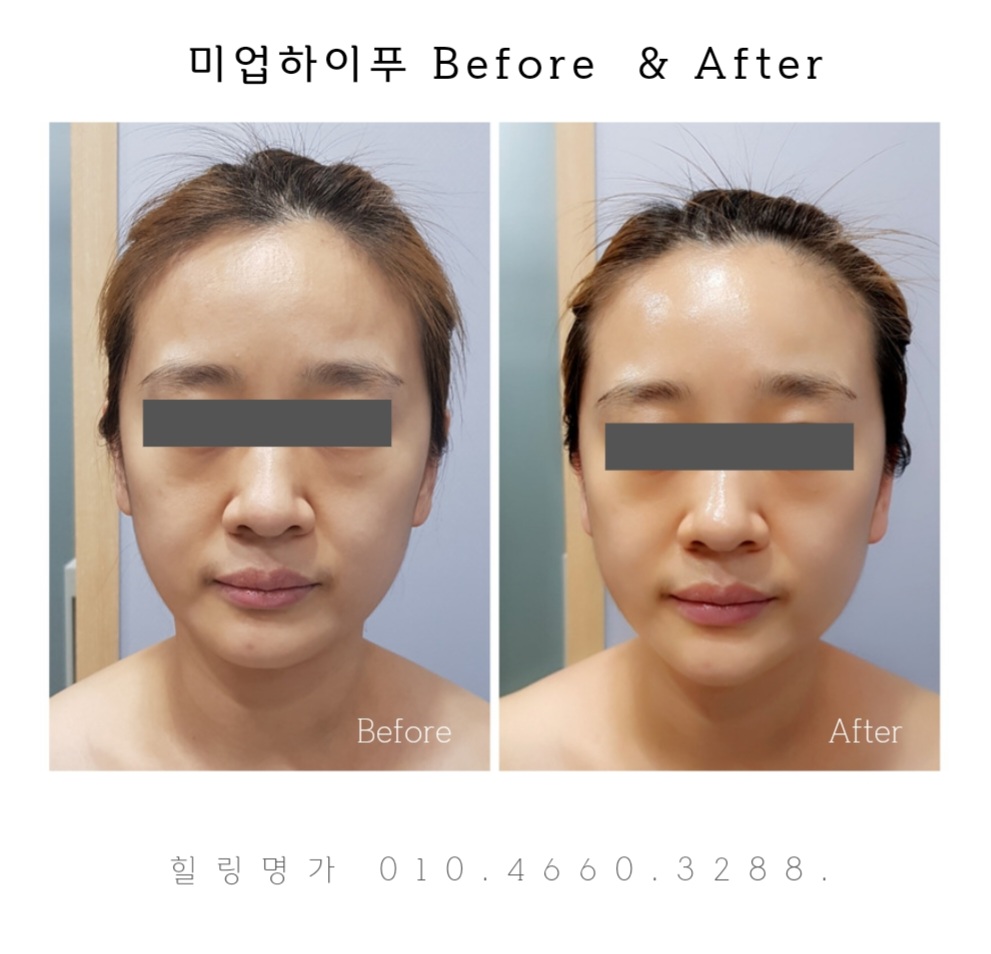 힐링명가