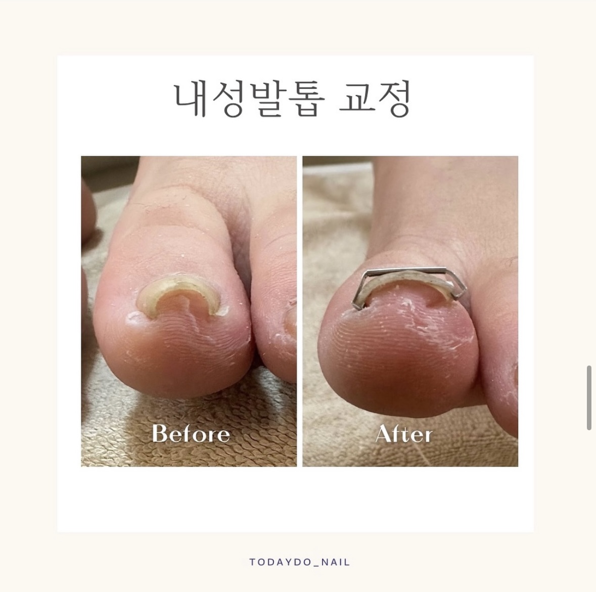 오늘도네일