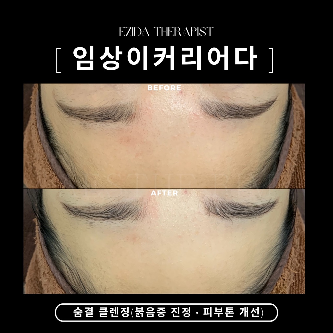 에스떼 림 이지다 대표 이미지