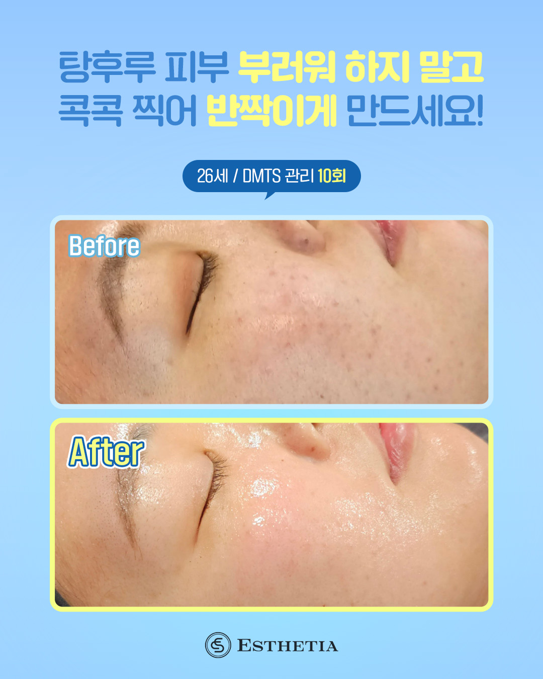 에스테티아 충북혁신1호점 photo 8
