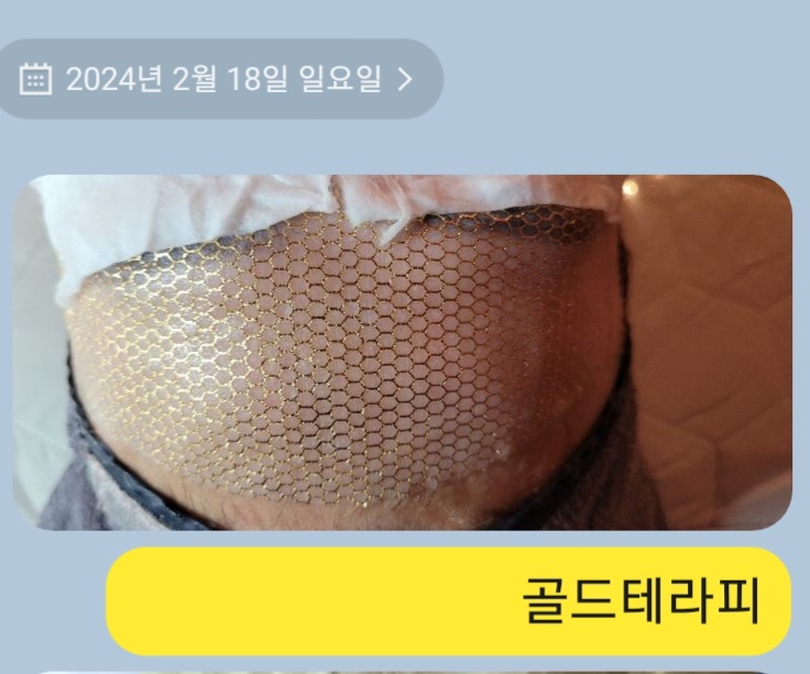 스킨케어톡 부평점