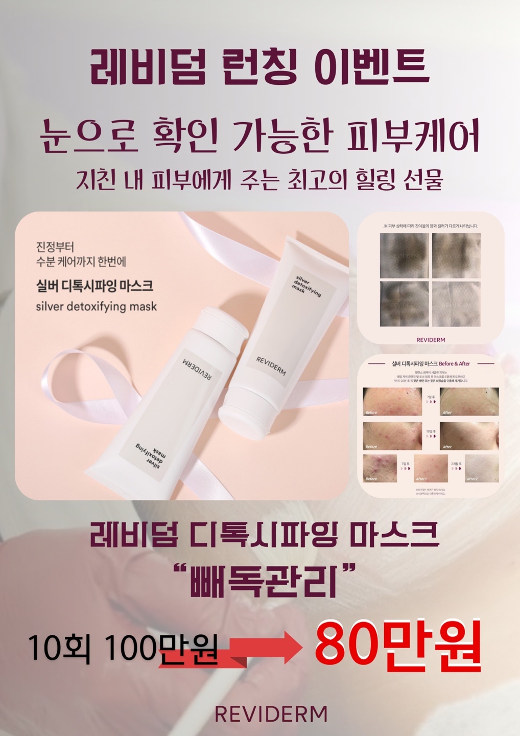 영바디케어
