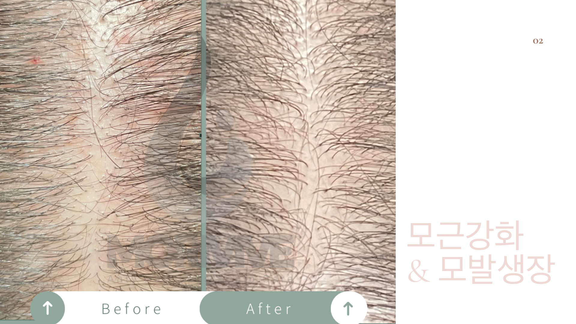 허진헤어아토 & 모리바이브 교육지사