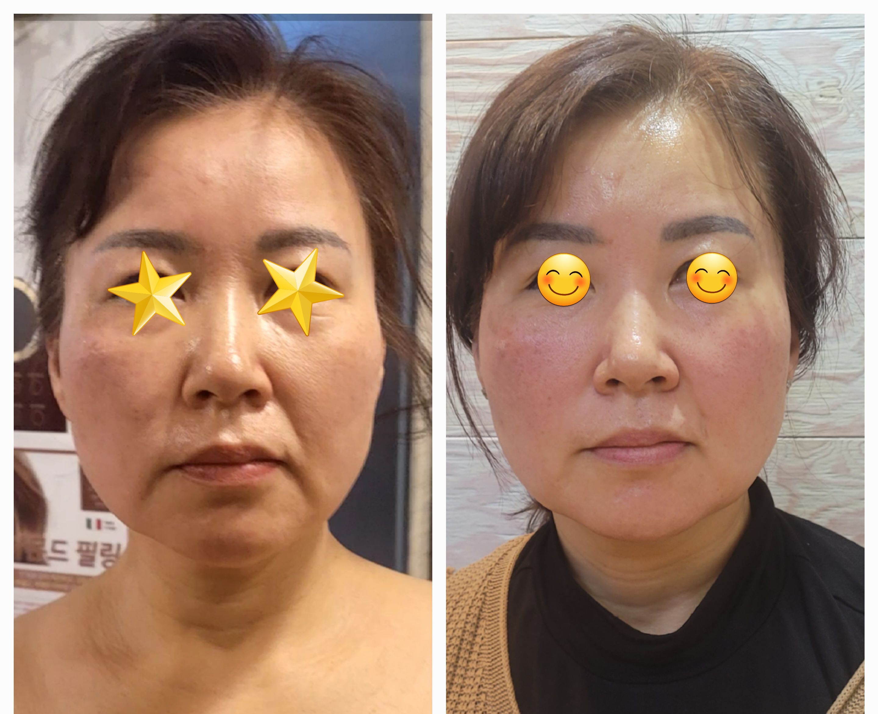 예쁨토탈뷰티샵 photo 8