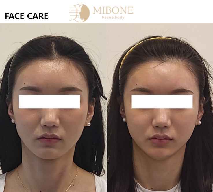수뷰티&귀족다이어트