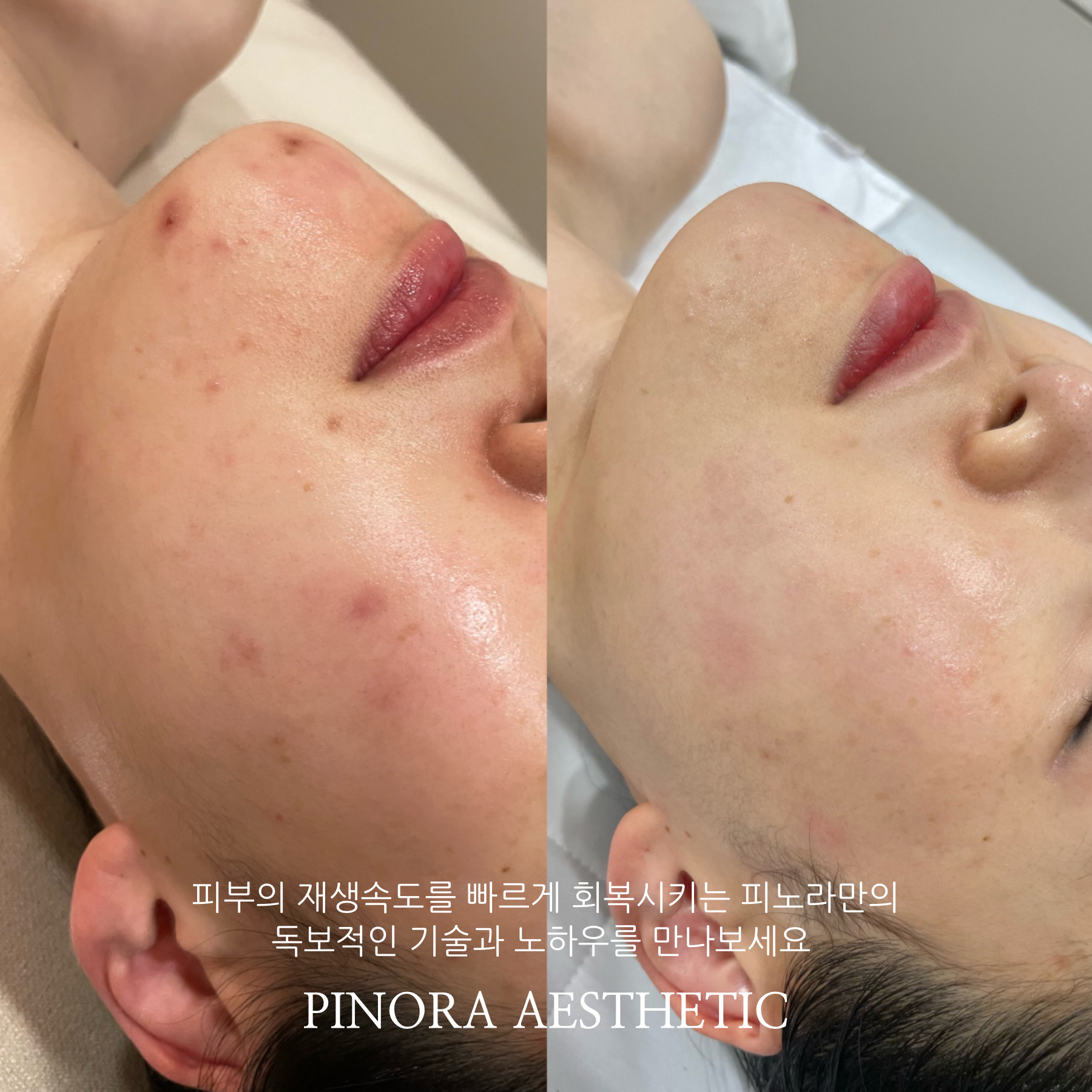 피노라에스테틱