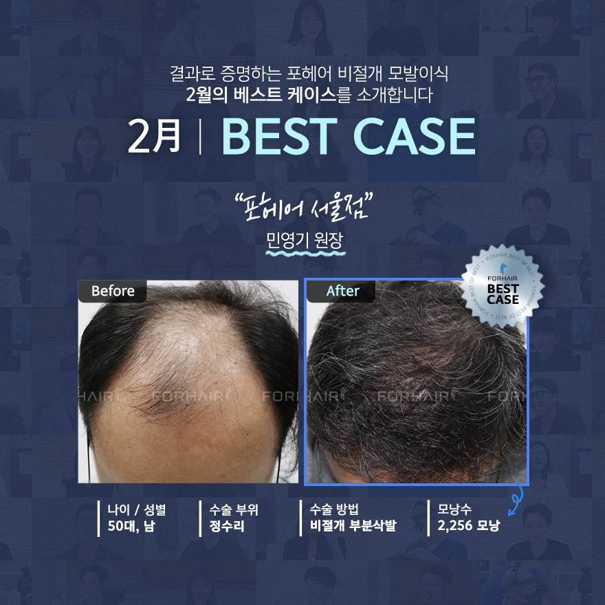 포헤어의원 서울점 대표 이미지