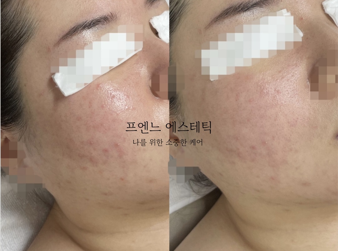 라온제이 에스테틱