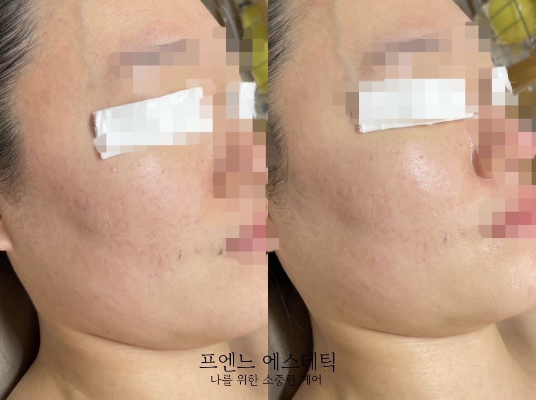 라온제이 에스테틱