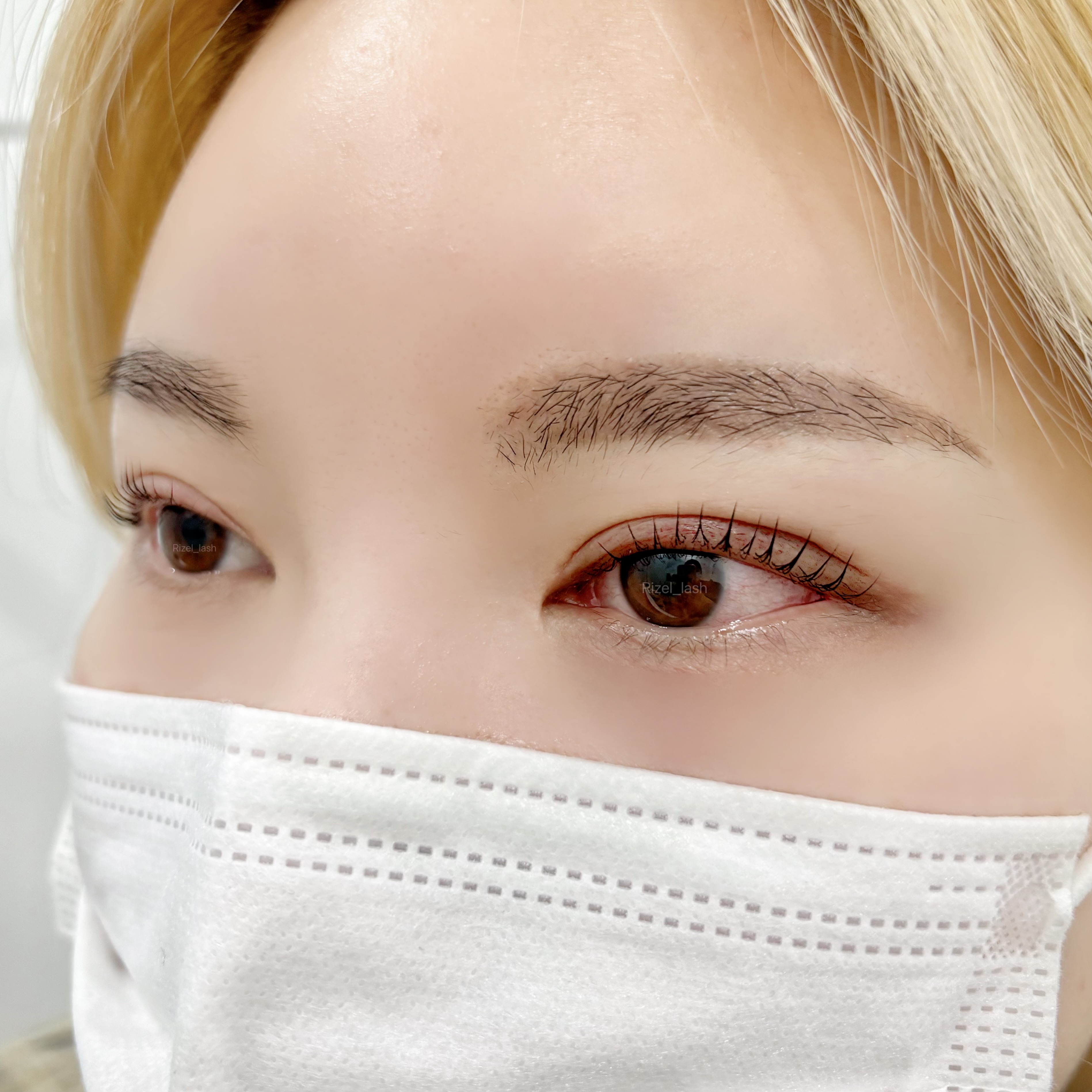 리젤래쉬