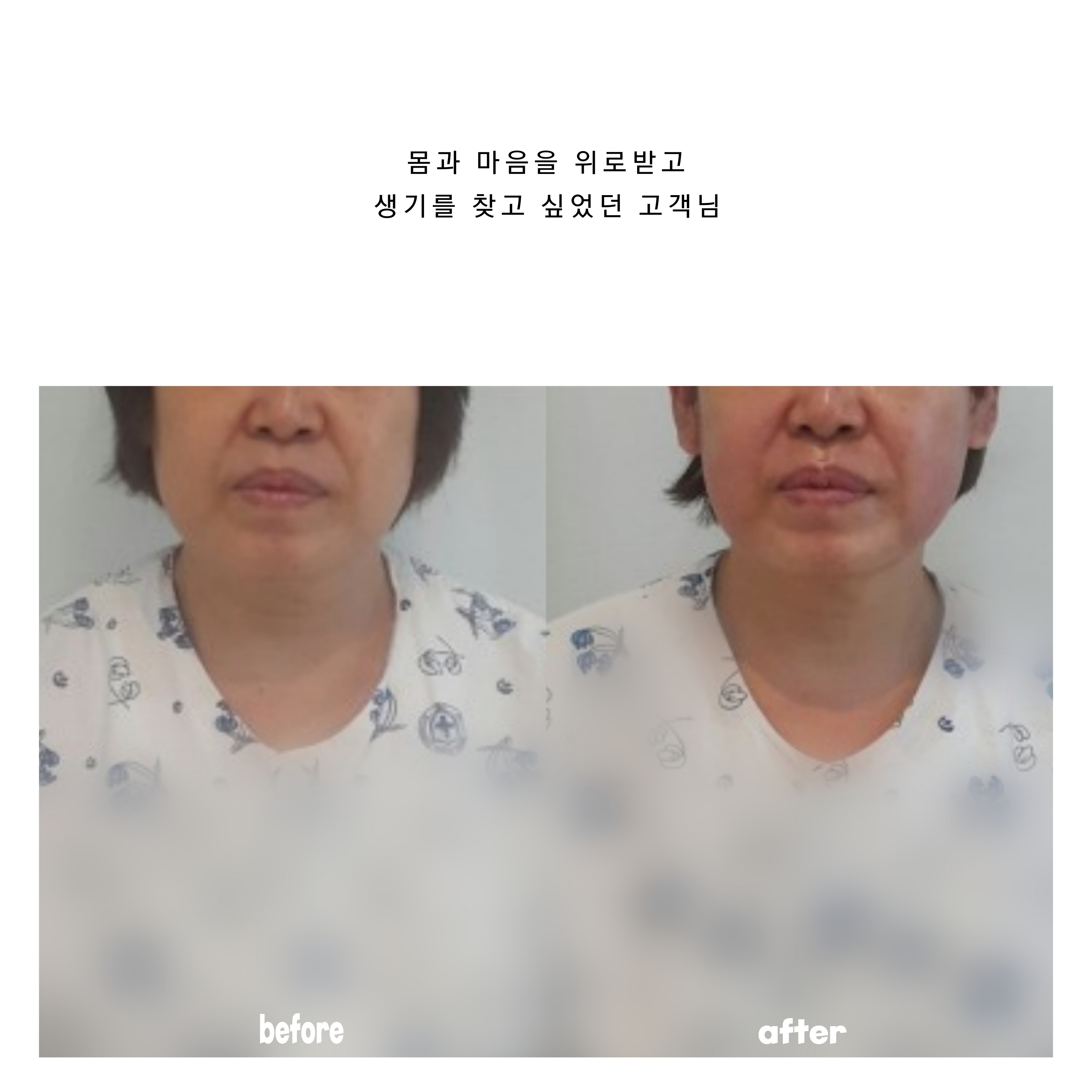 더테라피샵