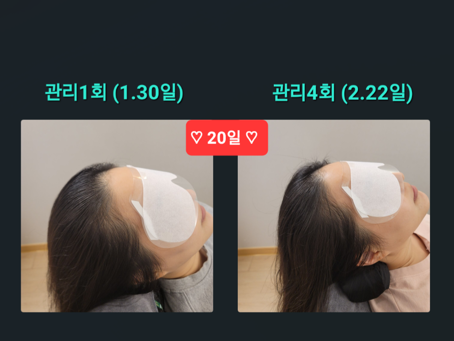 SUN 스칼프 크리닉 대표 이미지