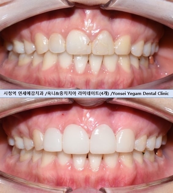 연세예감치과의원 대표 이미지