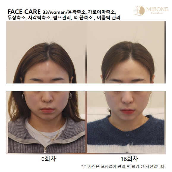 미본 얼굴윤곽관리 강남점 photo 8
