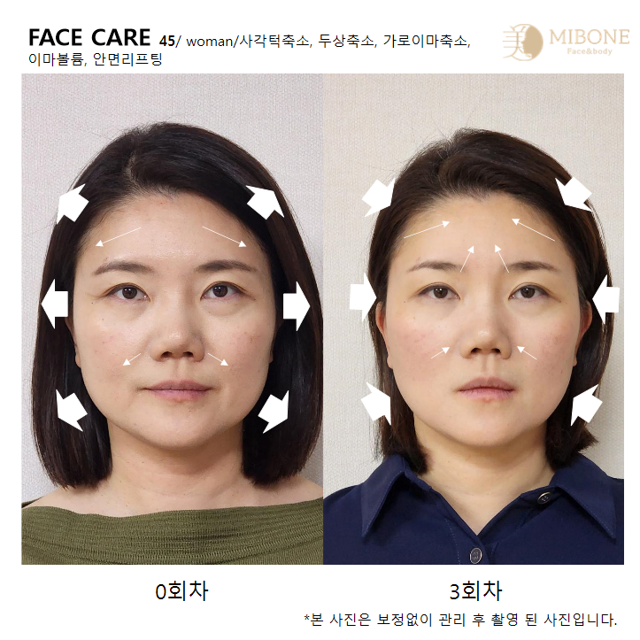 미본 얼굴윤곽관리 강남점 대표 이미지