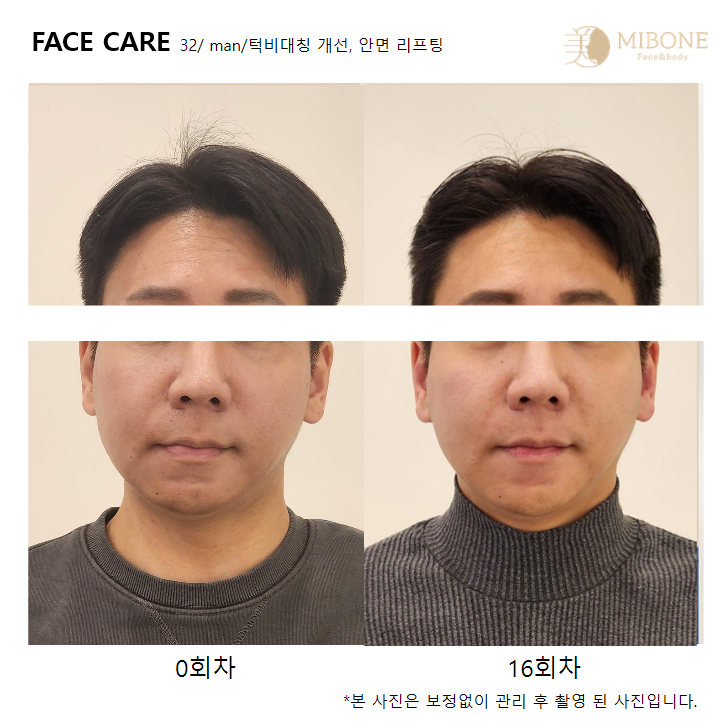 미본 얼굴윤곽관리 강남점 대표 이미지