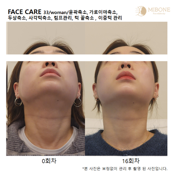 미본 얼굴윤곽관리 강남점 photo 4