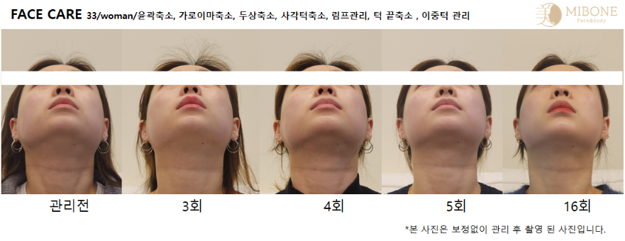 미본 얼굴윤곽관리 강남점 photo 5