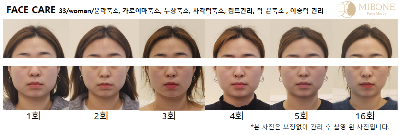 미본 얼굴윤곽관리 강남점 photo 3