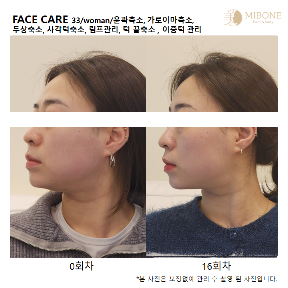 미본 얼굴윤곽관리 강남점 대표 이미지