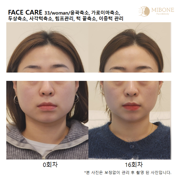 미본 얼굴윤곽관리 강남점 photo 2