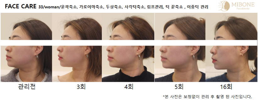 미본 얼굴윤곽관리 강남점 photo 7