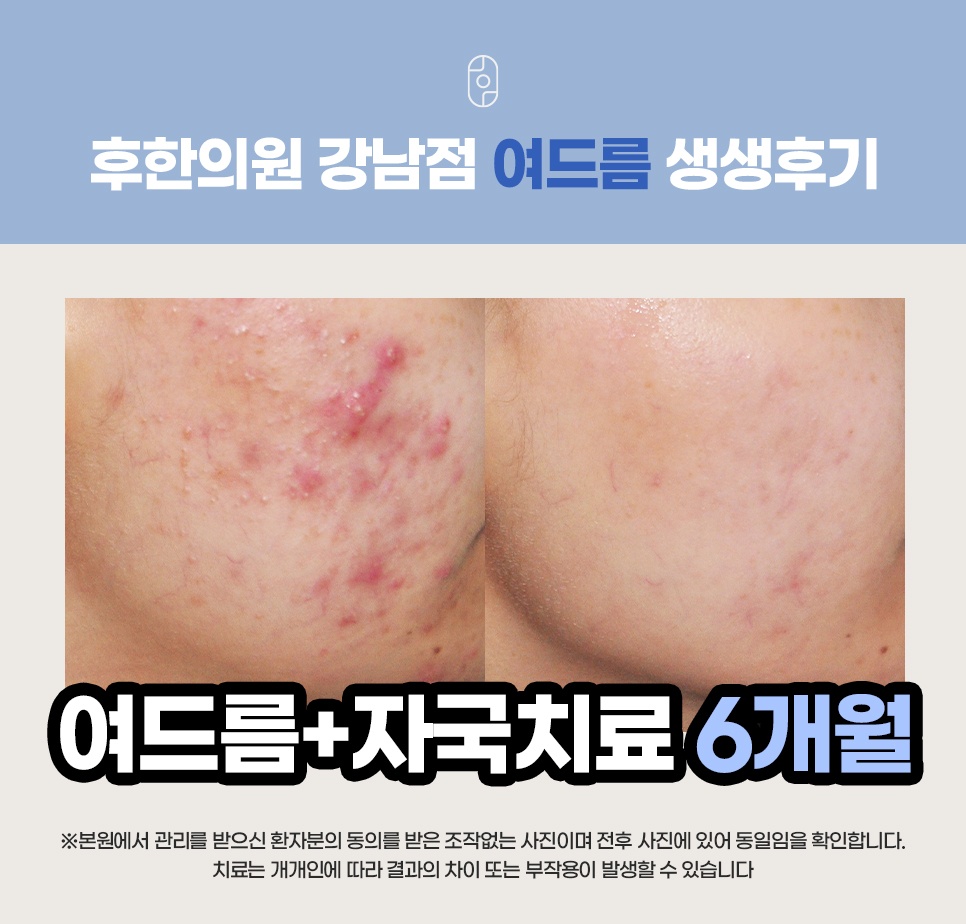 후한의원 강남