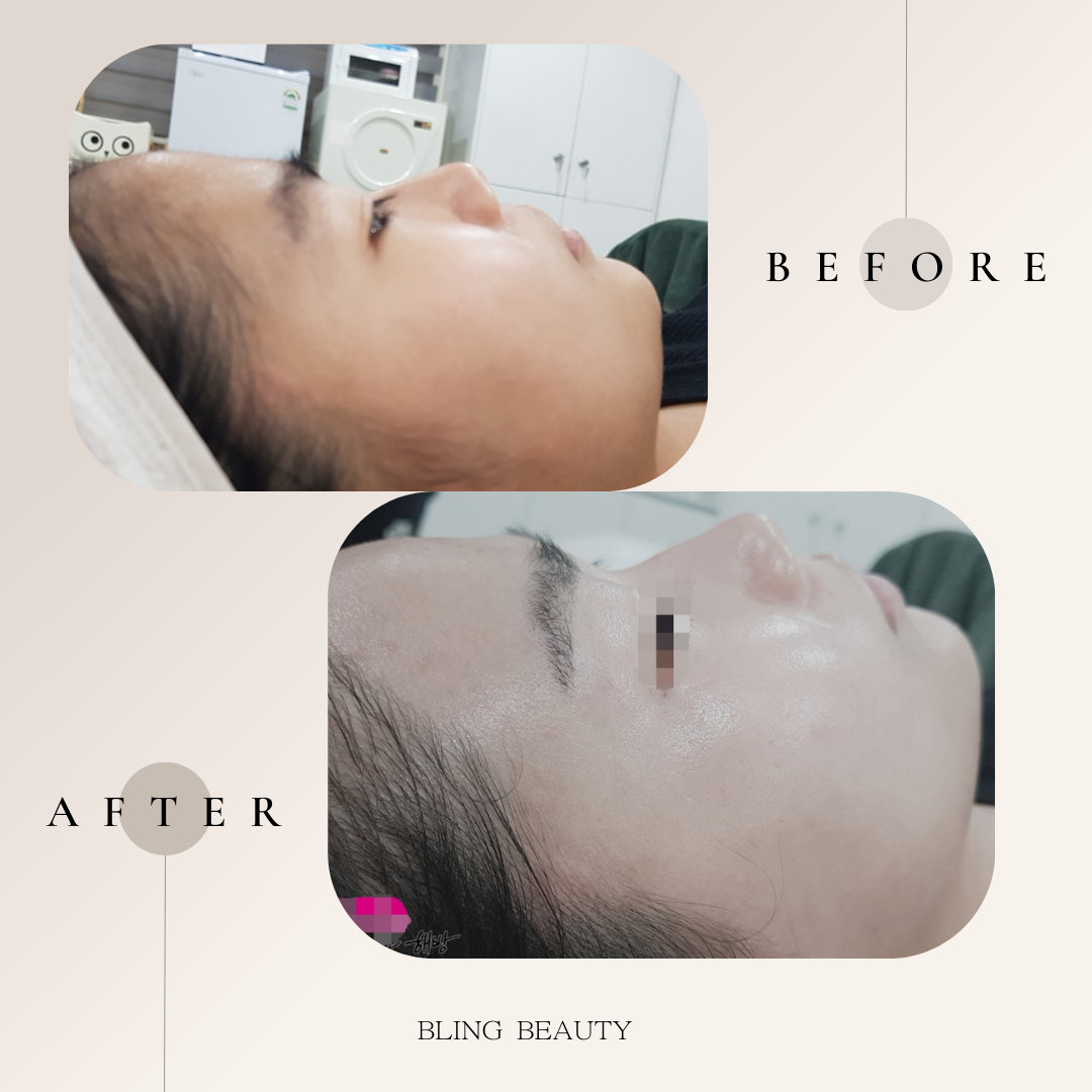 블링뷰티 대표 이미지