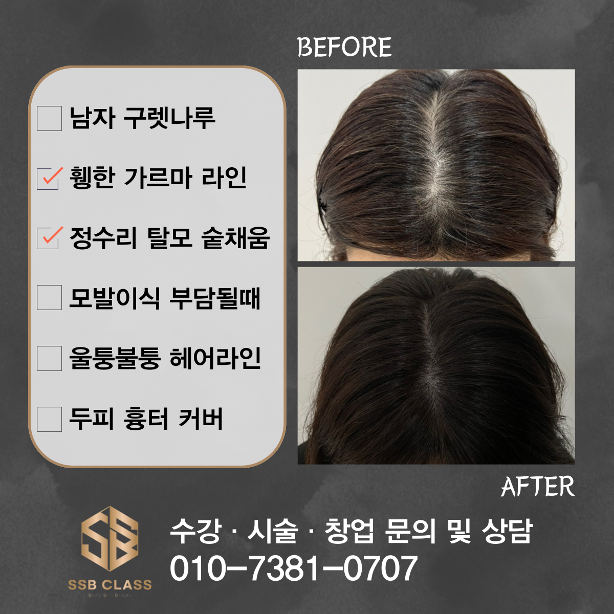 에스에스비클라스