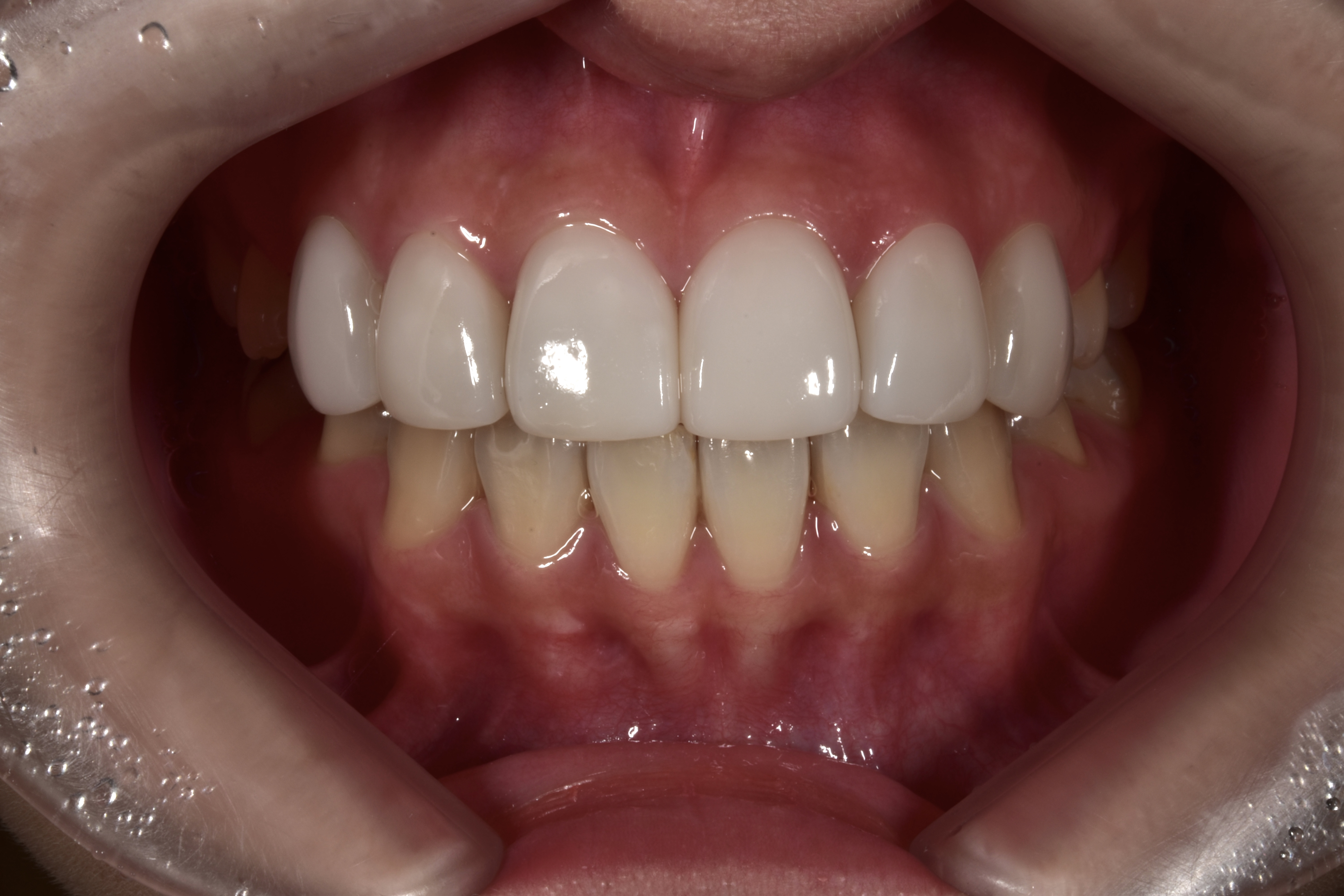 더블유치과기공소 대표 이미지