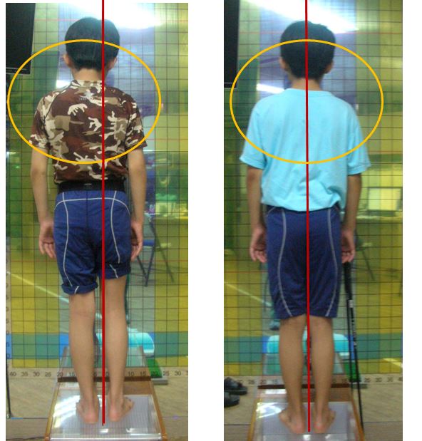 건밴드자세교정/통증/재활 대표 이미지