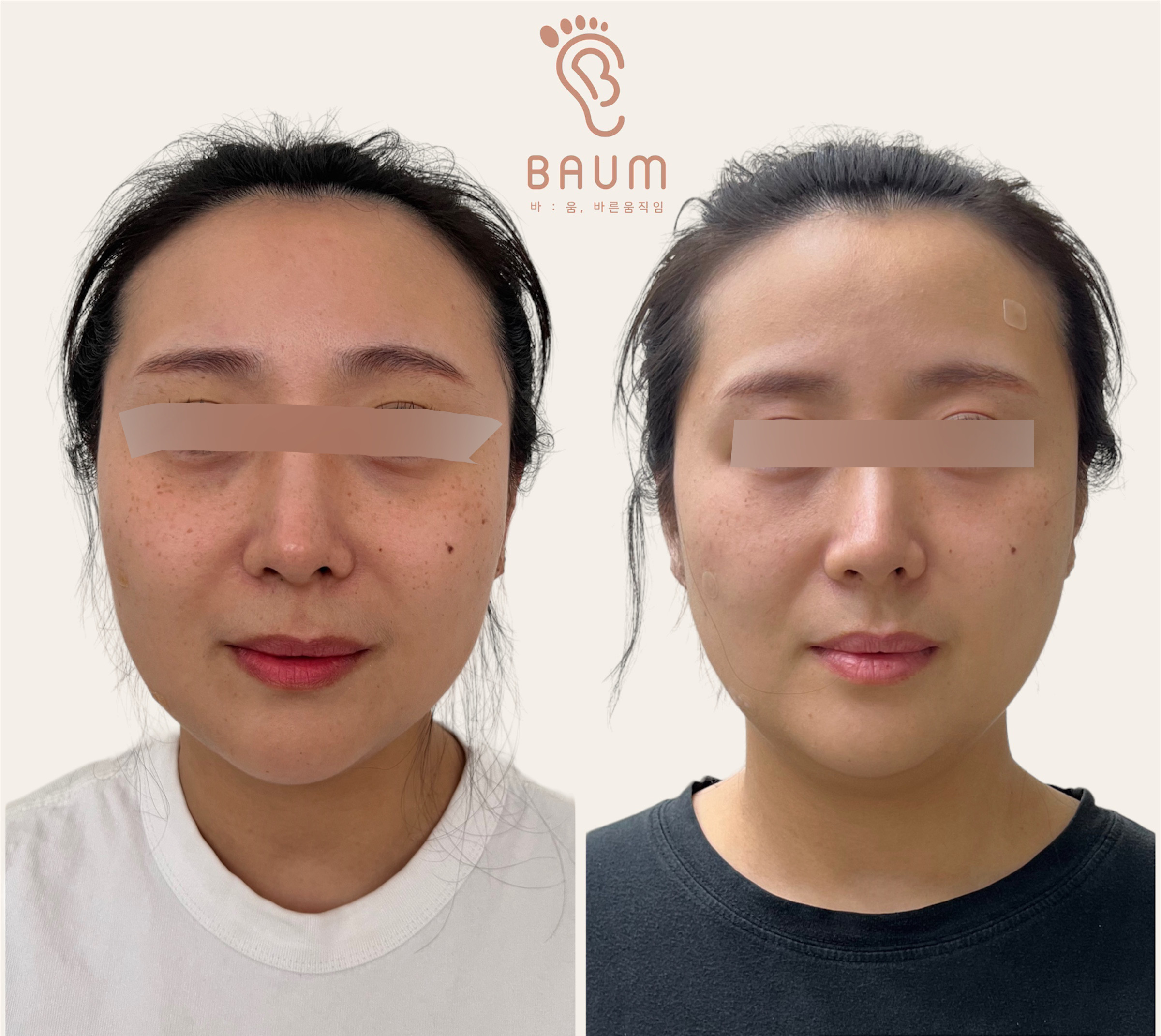 바움 대표 이미지