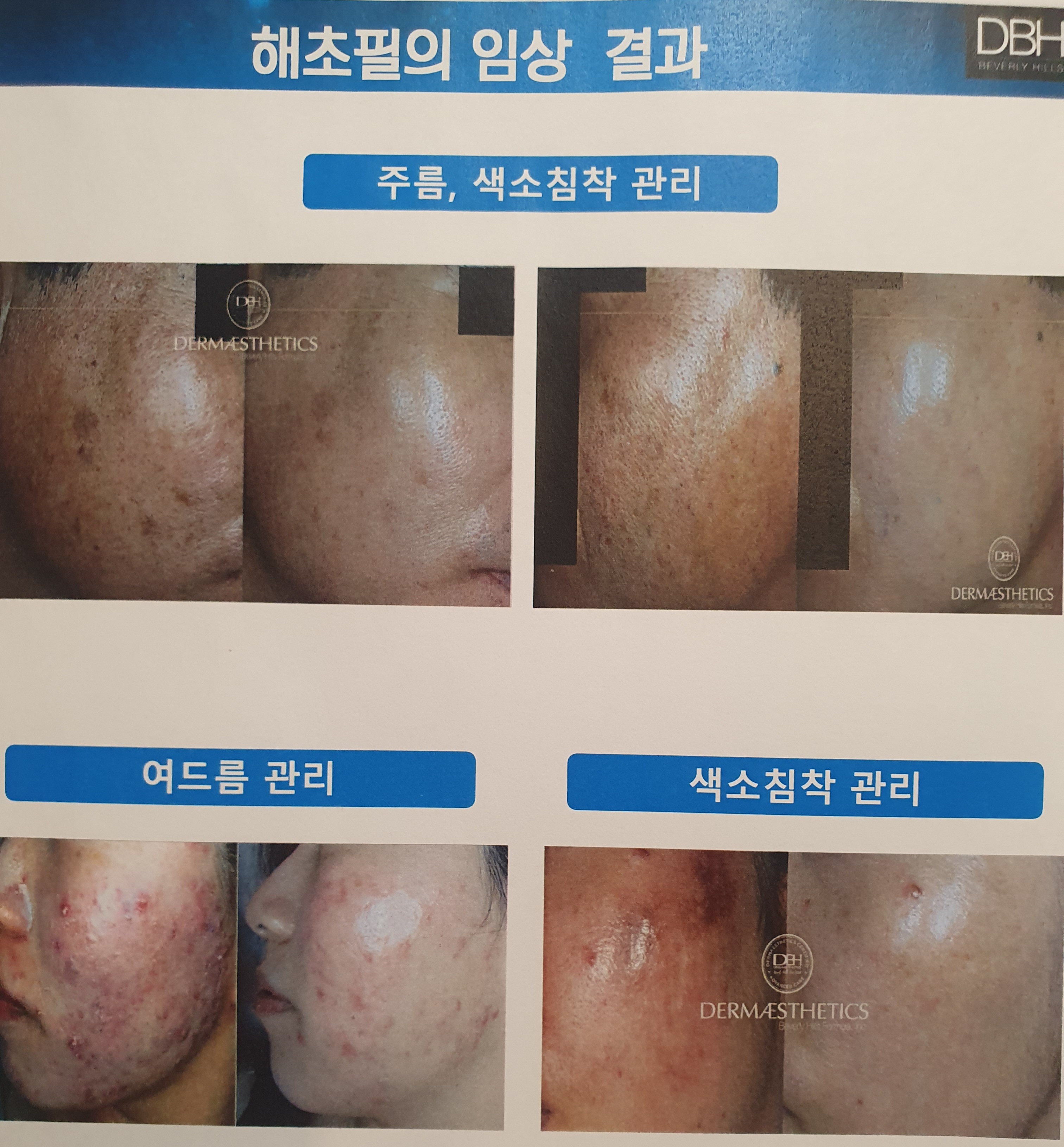 오렌지피부샵