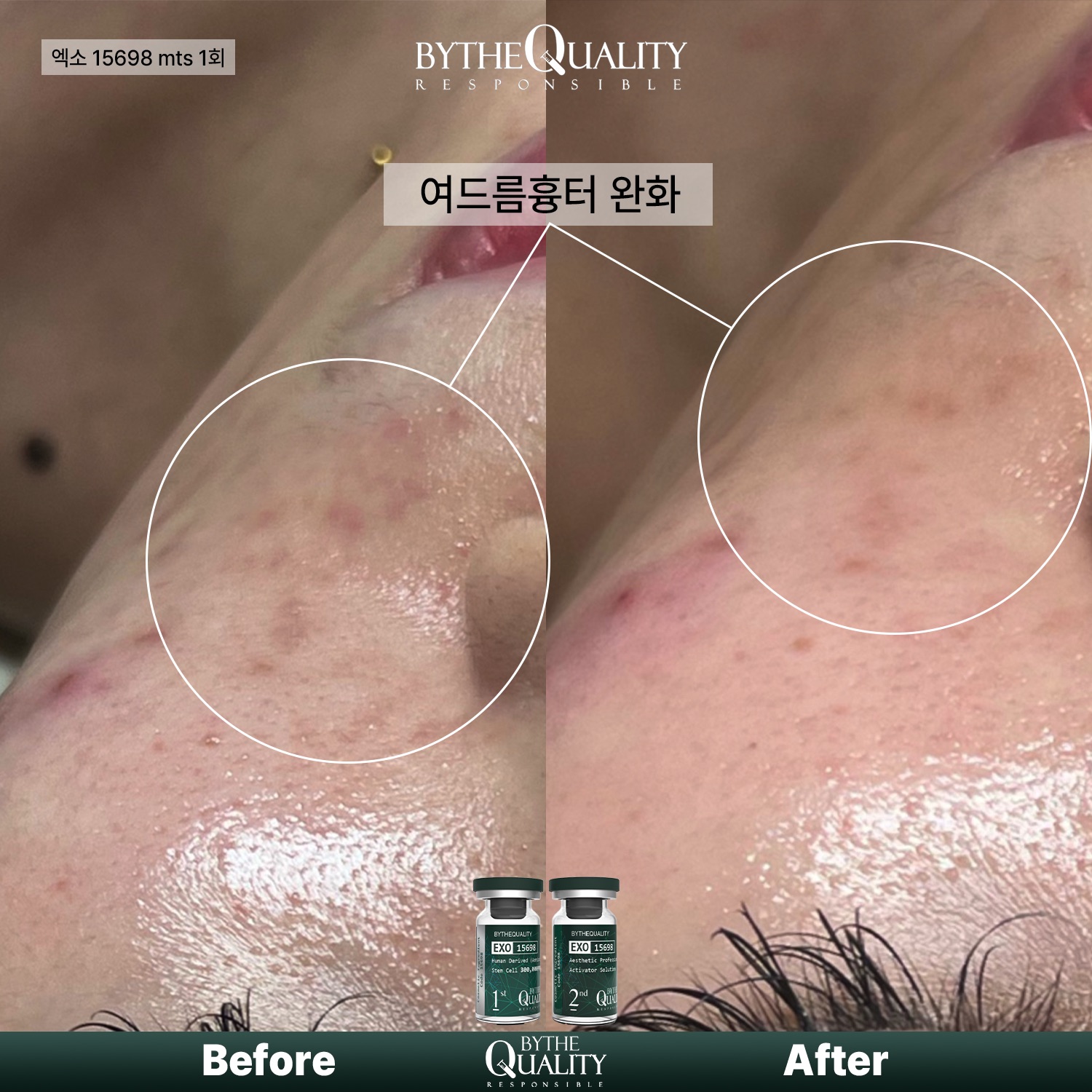 뷰티노리터 대표 이미지