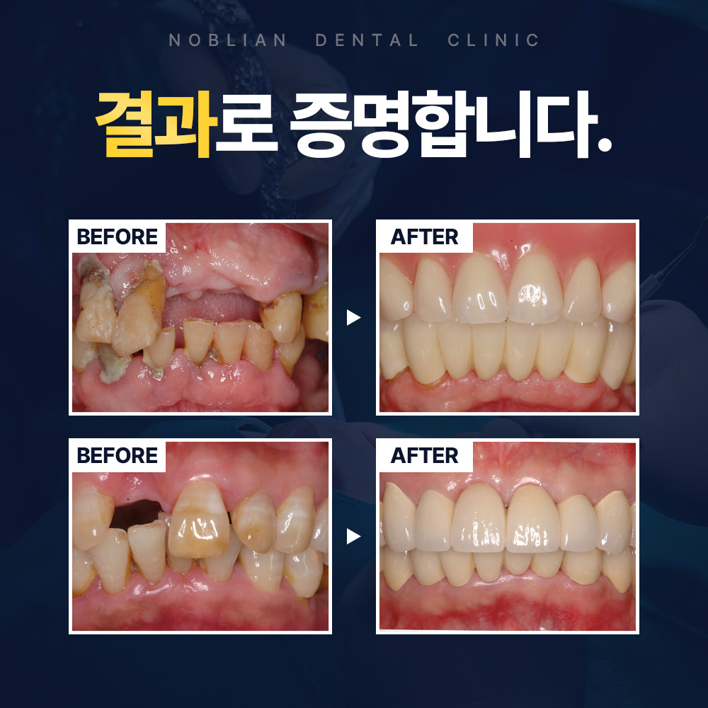 노블리안치과의원 대표 이미지