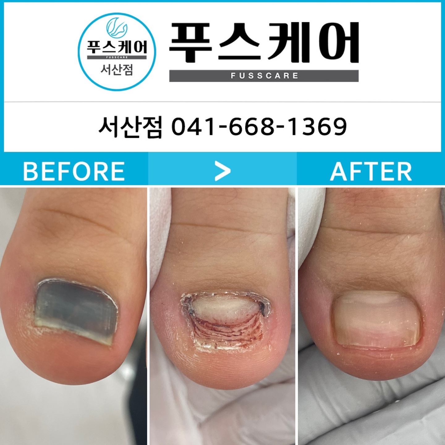 포쉬네일 푸스케어 이마트서산점