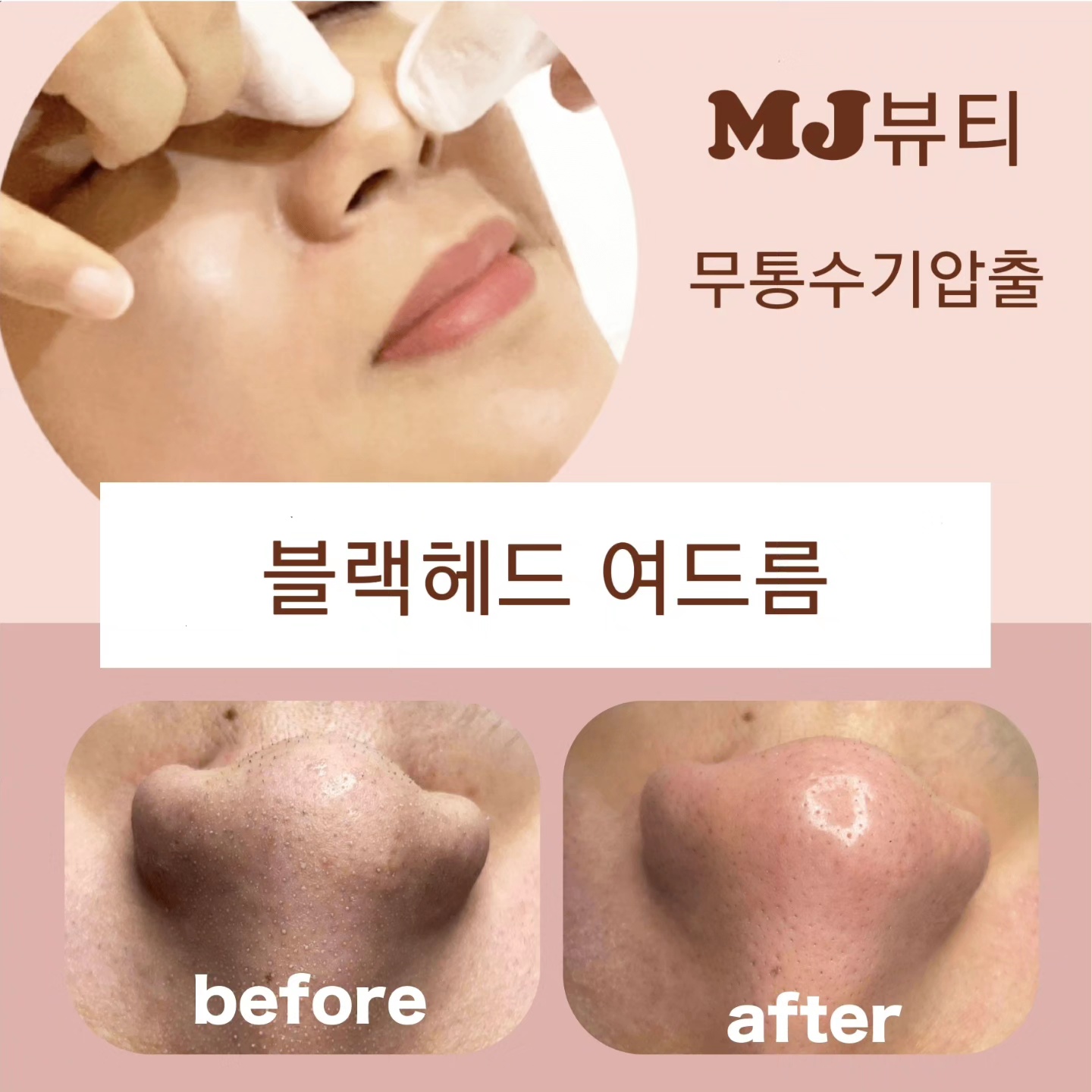 MJ뷰티