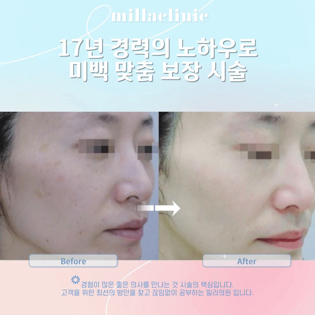 밀라의원 대표 이미지