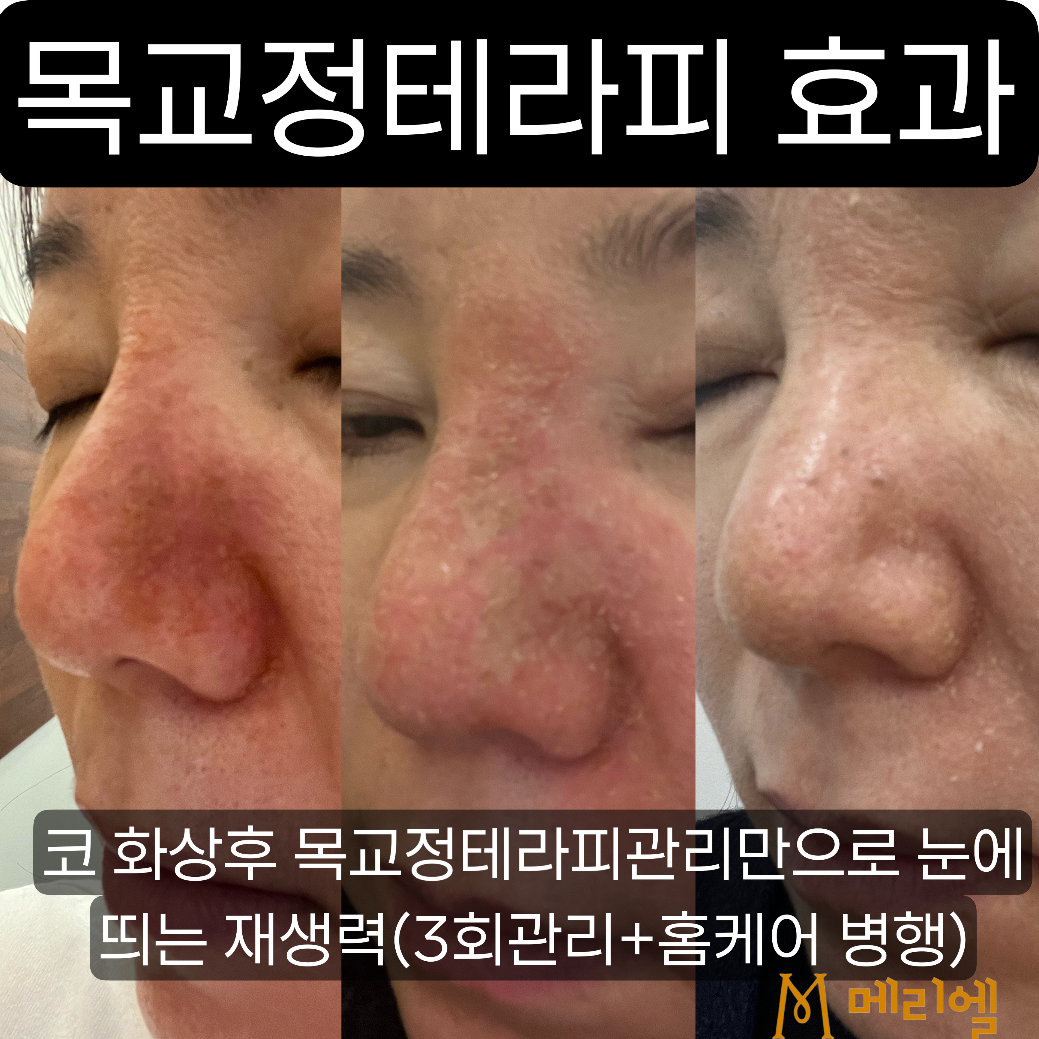 메리엘스킨케어 대표 이미지