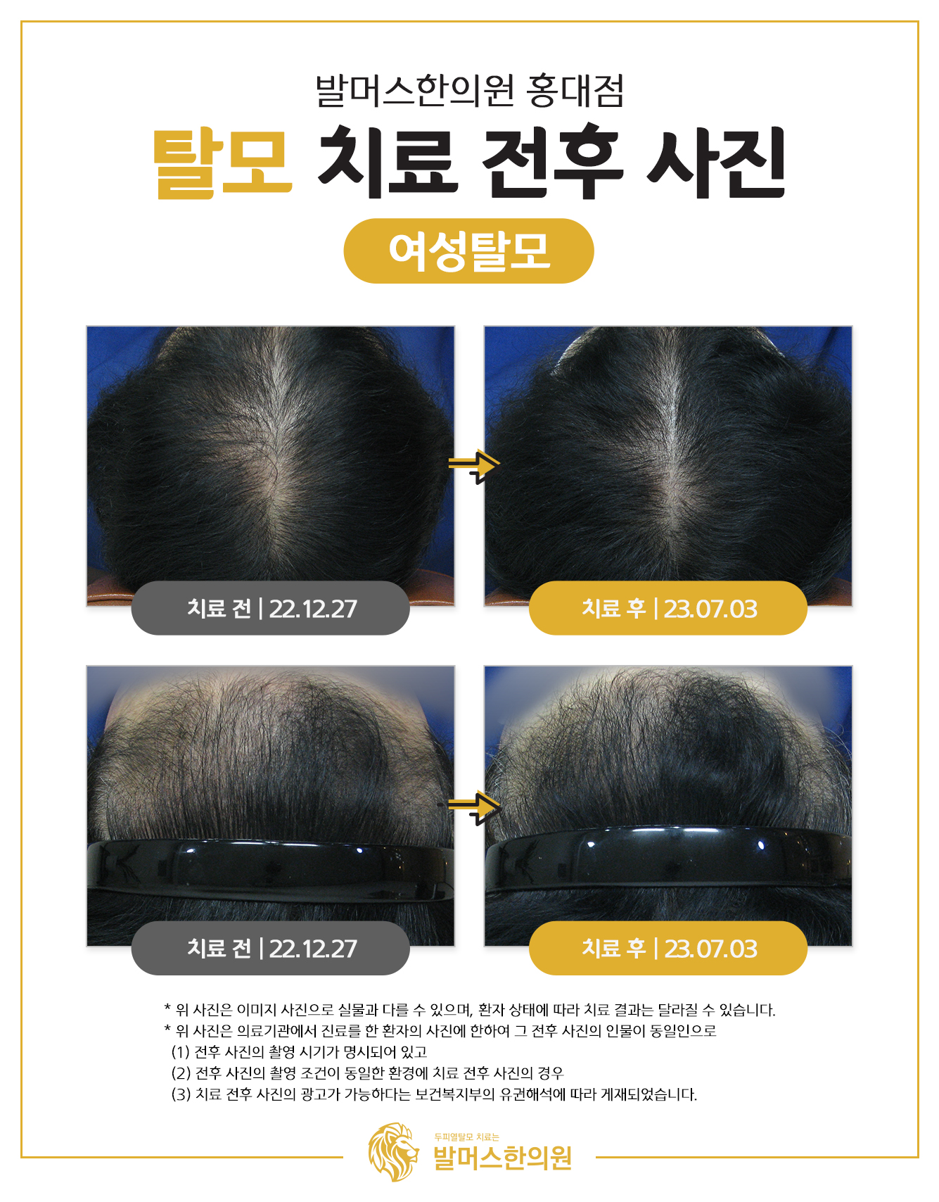 발머스한의원 홍대 대표 이미지