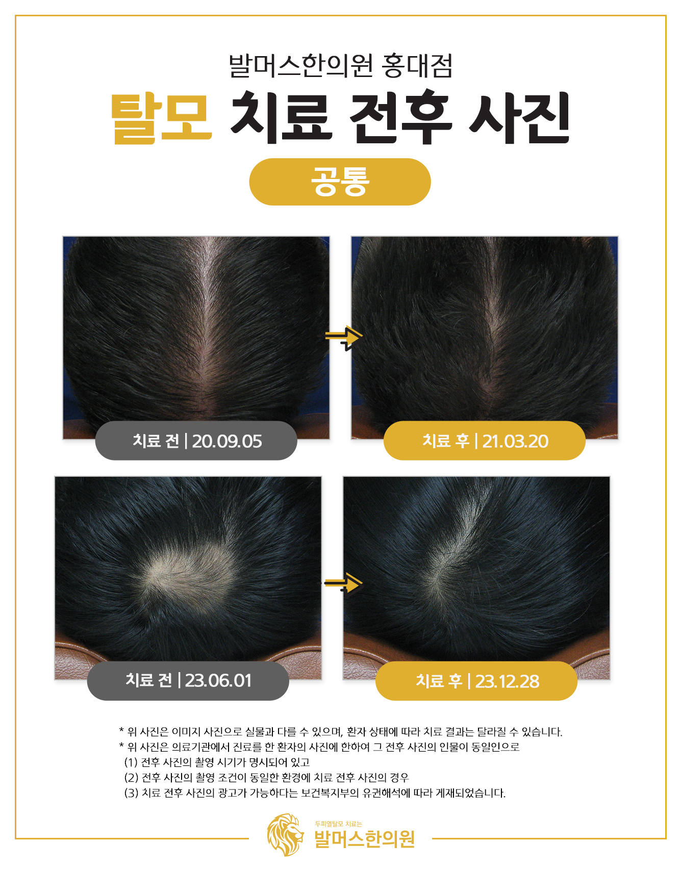 발머스한의원 홍대 대표 이미지