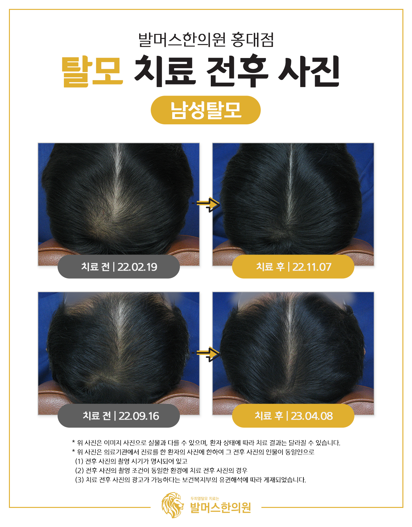 발머스한의원 홍대 대표 이미지